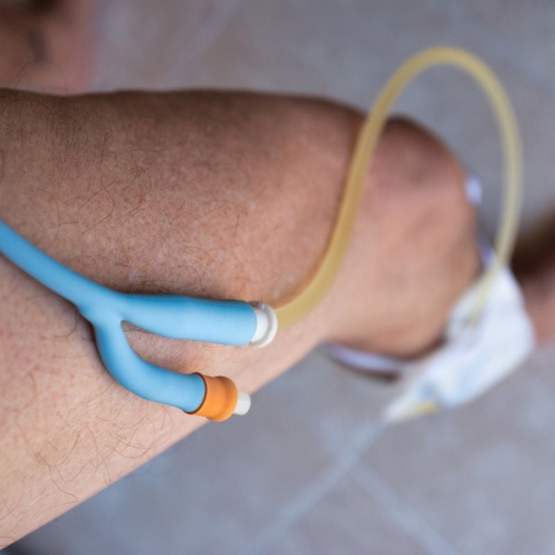 External catheter sits on top of leg with bag attached below.